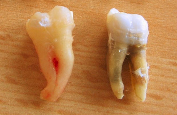 teeth